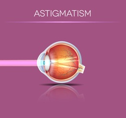 Illustration of astigmatism