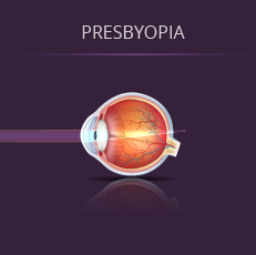 Illustration of presbyopia